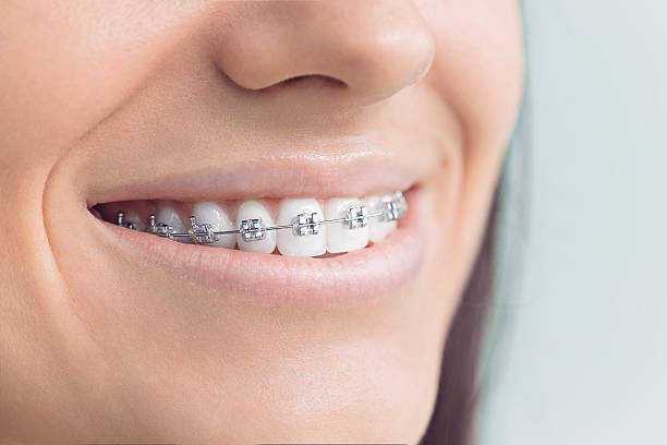 Best Teeth Whitening  in Byron, IL
